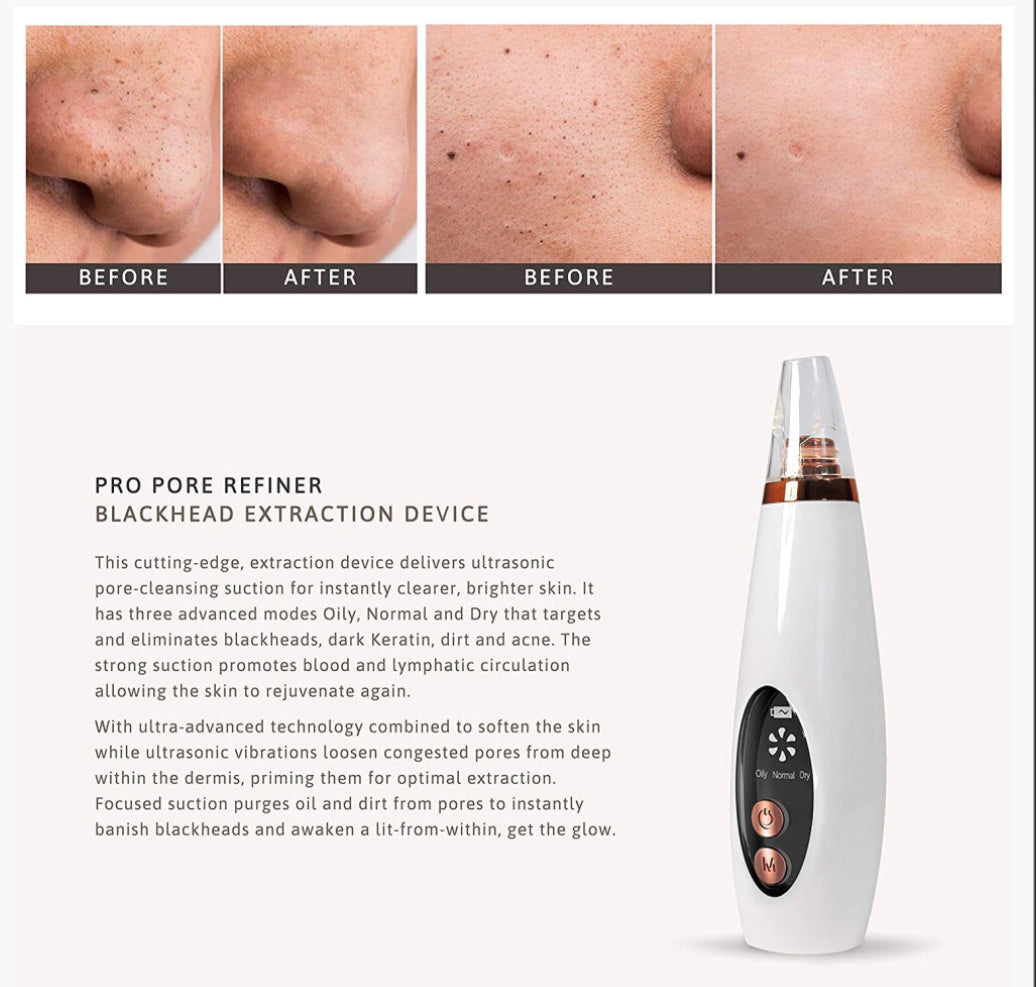 Electric Black Head Remover